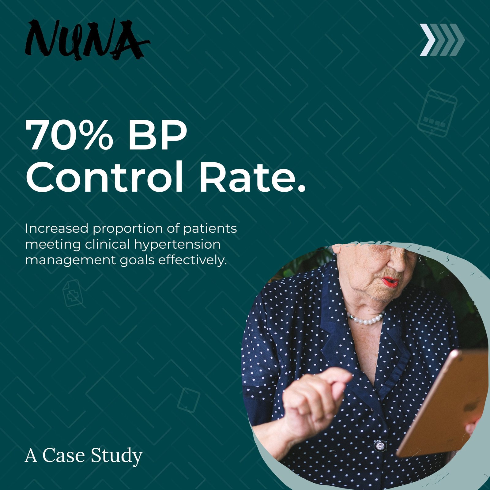 Nuna-Carousel-Post (3)